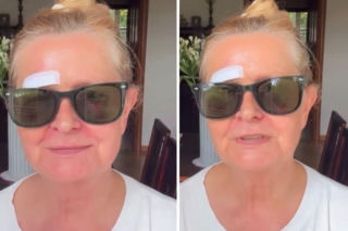 Barbara Busztynowicz miała wypadek! Skończyło się szyciem. Nikt się nie zatrzymał