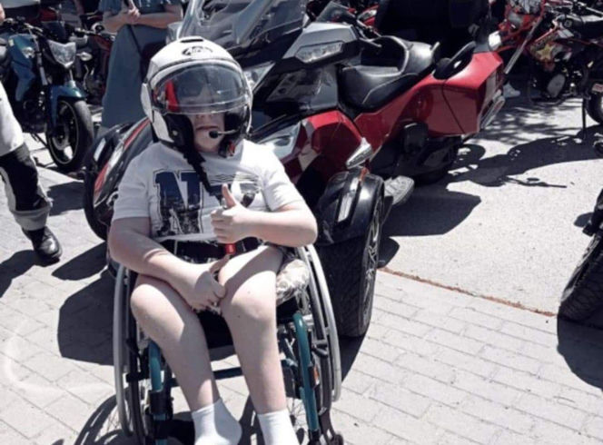 Gabryś przeszedł 17 operacji, tylko na twarzy i dłoniach nie ma blizn. Jego pają jest pomoc innym!