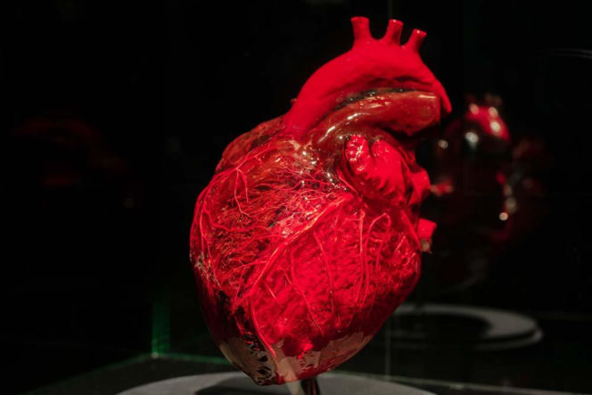 Body Worlds