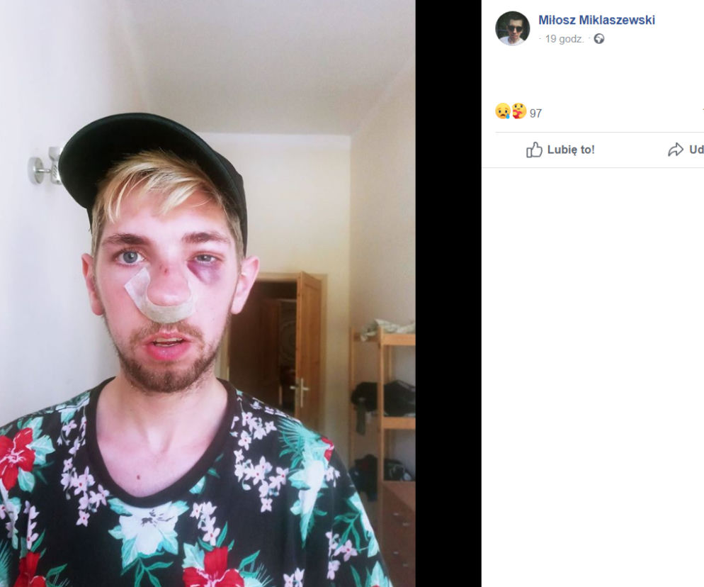 Pan Miłosz po pobiciu nad Rusałką