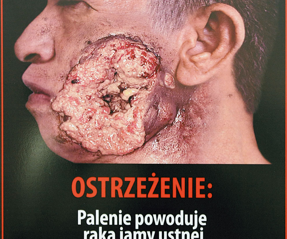 Nie pal