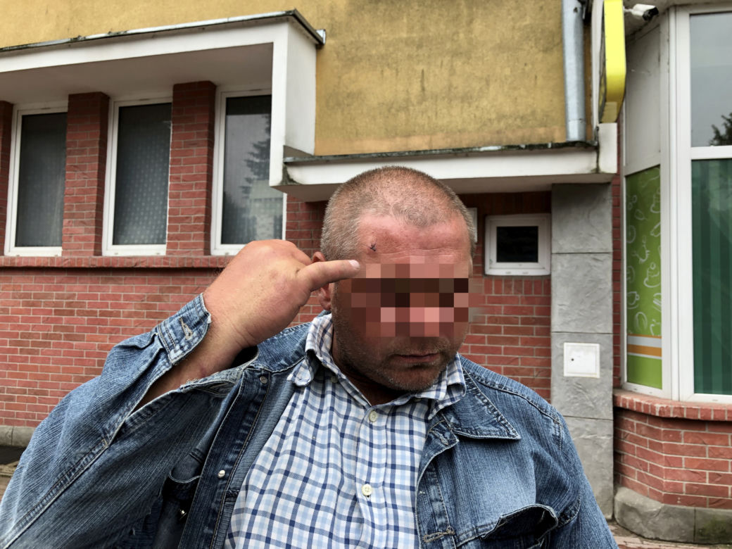 "Bratanek zagrał moją głową w golfa". Dwa ciosy i pan Tomek padł jak długi
