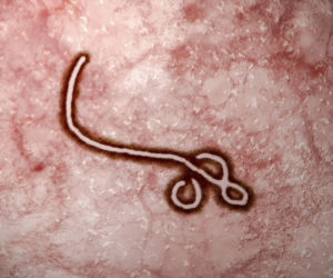 EBOLA