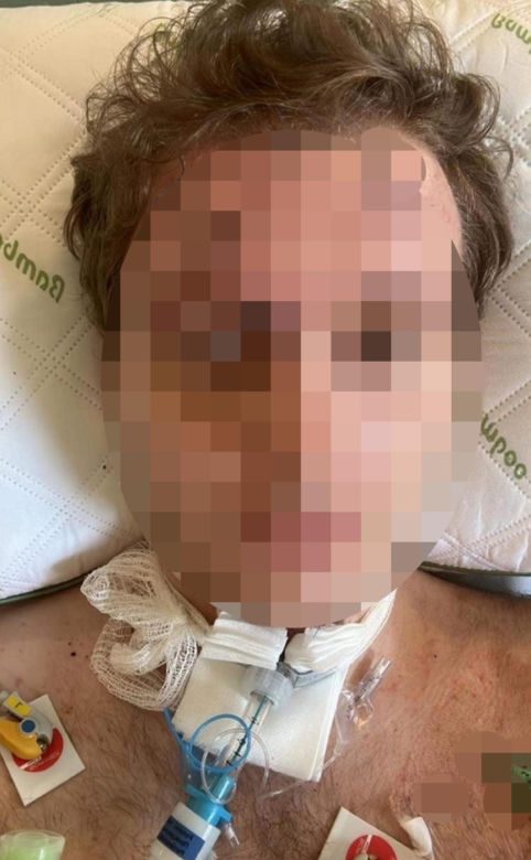 Świerklaniec. 31-latek doprowadził do dwóch wypadków. 5 osób rannych