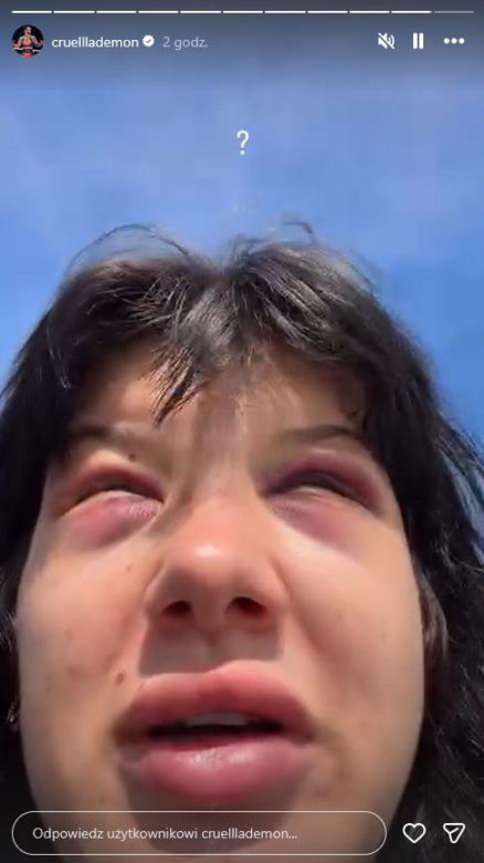Dominika Rybak po walce