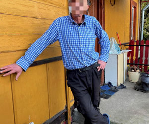 Łuków. Monika B. miała specjalnie szpecić swoją córkę. Mówiła, że to choroba. Koszmar trwał kilka lat