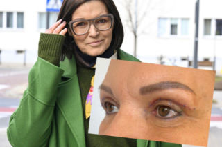 Ilona Felicjańska pokazała efekt zabiegu plastyki powiek. Drastyczne zdjęcia