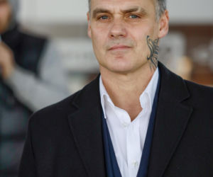 Jan Wieczorkowski przed przeszczepem włosów