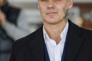 Jan Wieczorkowski przed przeszczepem włosów