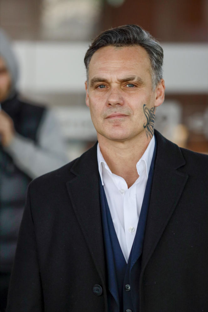 Jan Wieczorkowski przed przeszczepem włosów