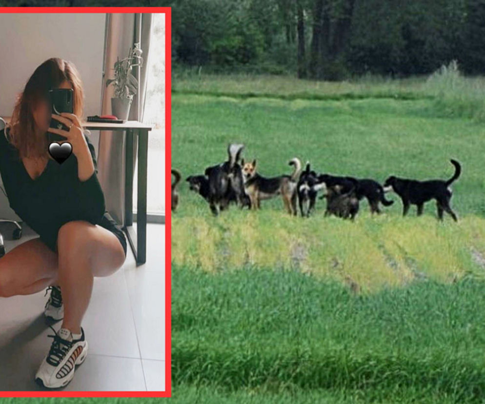 Horror 18-letniej Weroniki. Nastolatkę dopadły i rozszarpały psy. Nie ma twarzy [ZDJĘCIA]