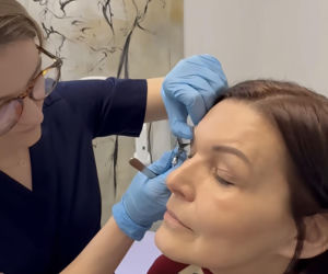 Ilona Felicjańska wycina sobie powieki