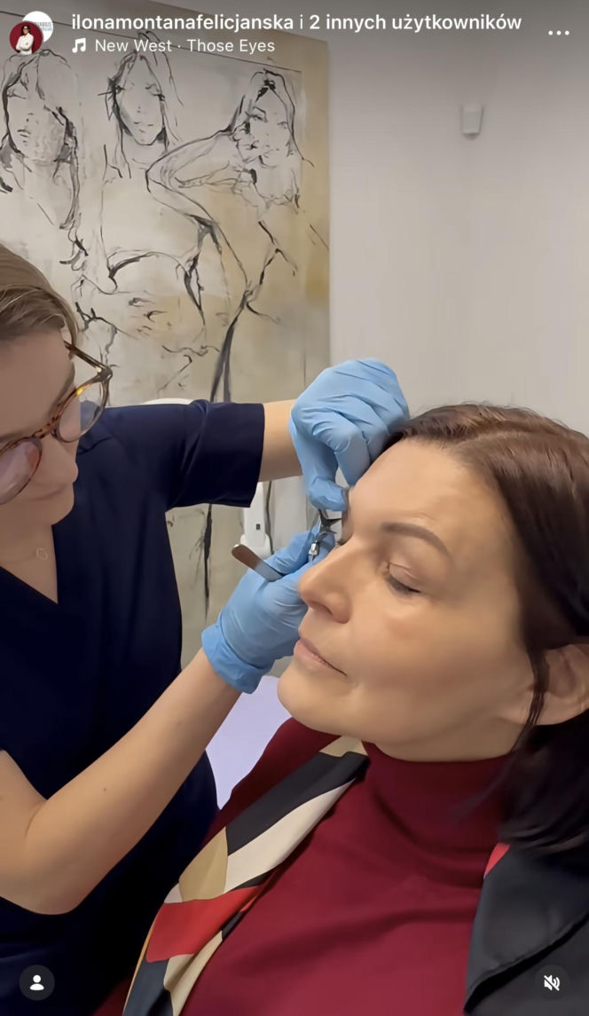 Ilona Felicjańska wycina sobie powieki