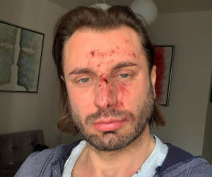 Rafał Grabias został pobity