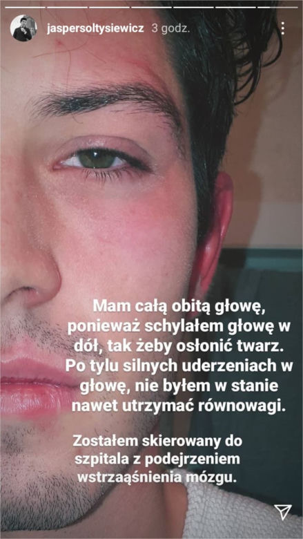 Gwiazdror "Barw szczęścia" oskarża policję o brutalne pobicie