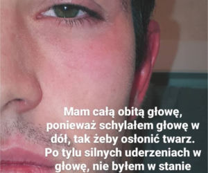 Gwiazdror Barw szczęścia oskarża policję o brutalne pobicie