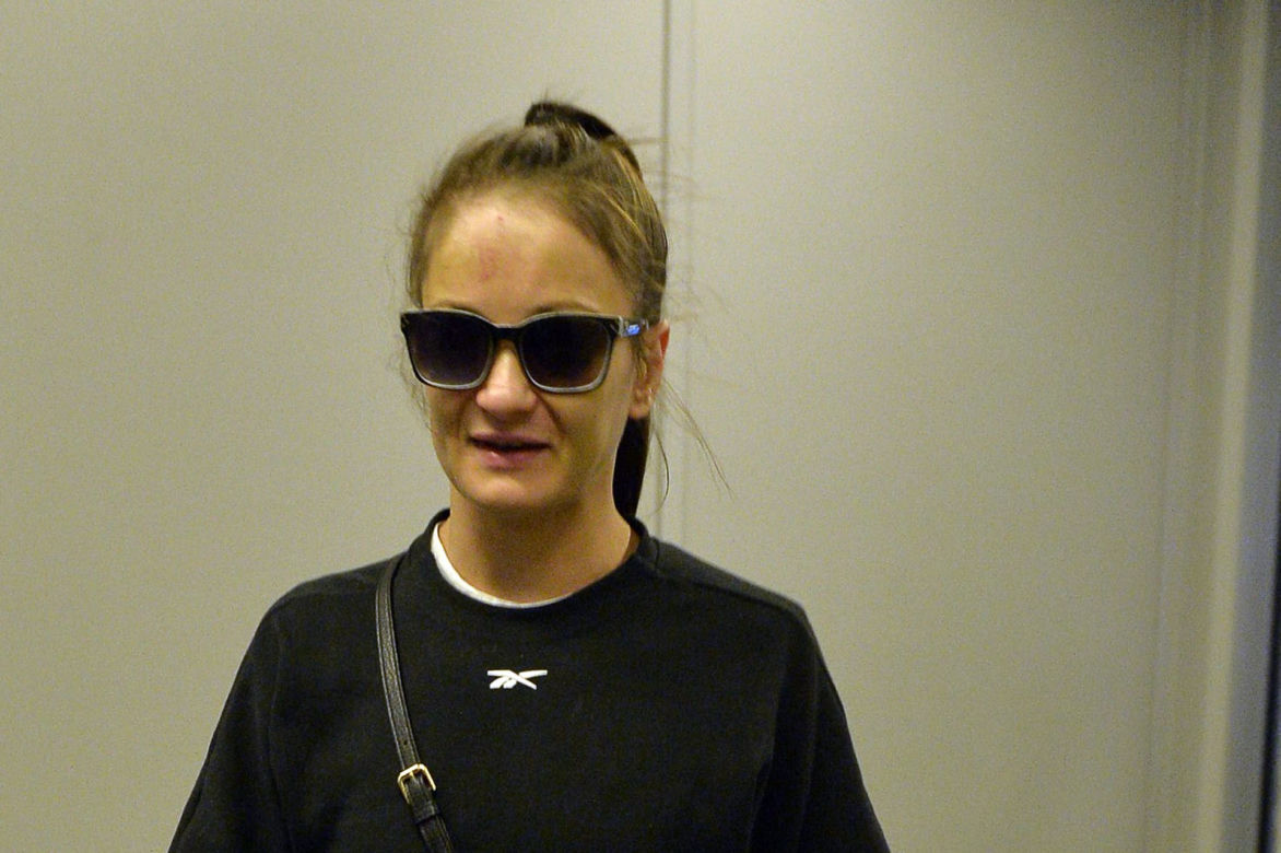 Kowalkiewicz wstawią w twarz metalowe blaszki