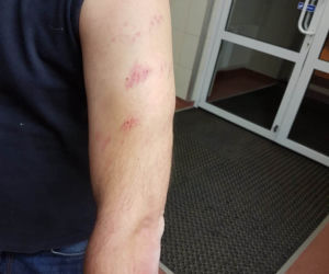 Dostałem zawału przez policję