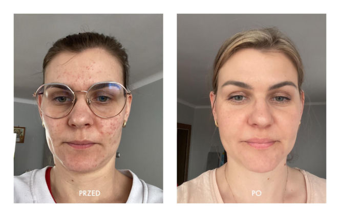 Ilona Szewczyk-Wasiak