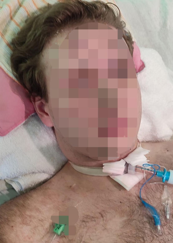 Świerklaniec. 31-latek doprowadził do dwóch wypadków. 5 osób rannych