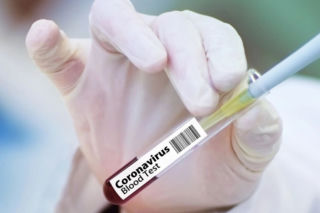 Koronawirus w Polsce. Ponad 11 TYSIĘCY nowych zakażeń. Ludzie MASOWO UMIERAJĄ! Przerażające [RAPORT, 18.12.2020]