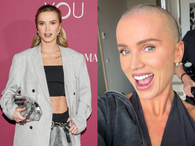 Gwiazdy zgoliły włosy w szczytnym celu