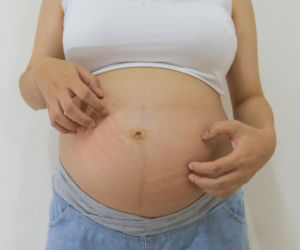 Zmiany skórne w ciąży to norma. Są jednak takie, które powinnaś pokazać lekarzowi