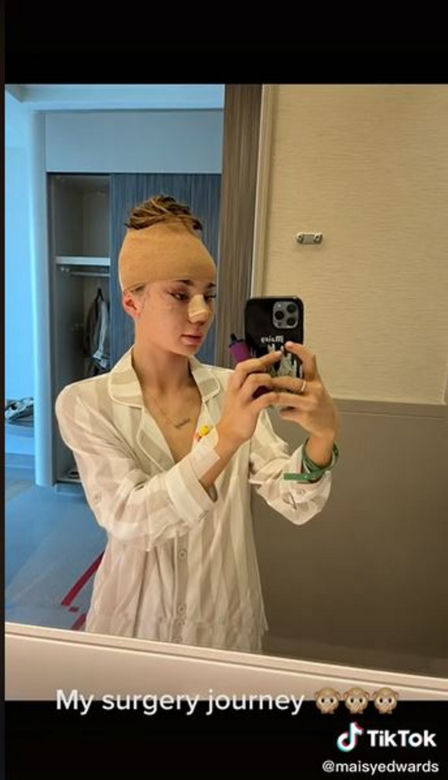 Znana influencerka pojechała do Turcji "zrobić" sobie nos. Wydała 50 tys. zł, fani bezlitośni: "Jest gorzej"