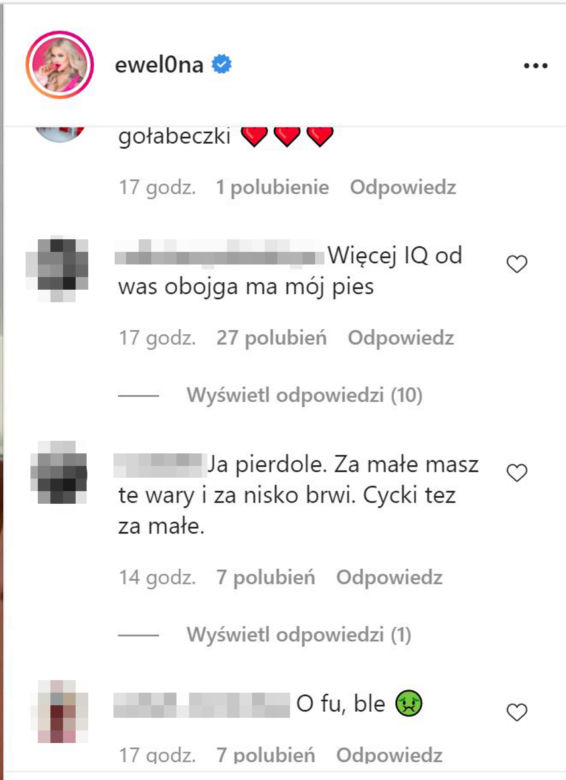 Ewelina z Warsaw Shore przesadziła z operacjami