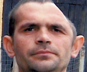 Lekarze dali mu pół głowy