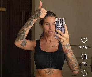 Karolina Gilon zoperowała biust. Zdjęcia przed i po