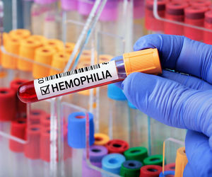 Hemofilia: Dorośli wciąż czekają