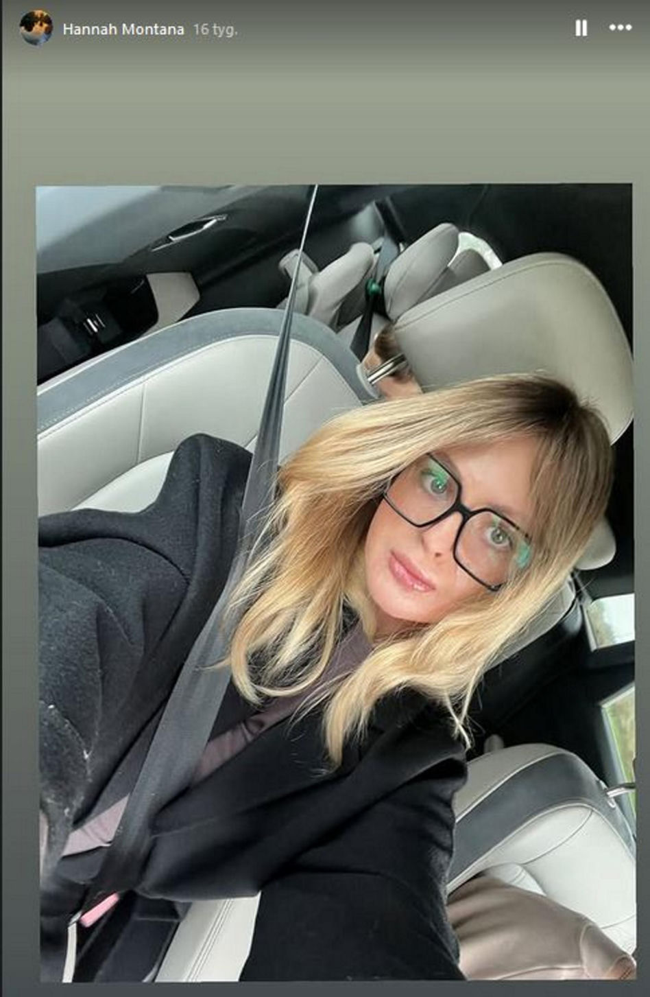 Maja Kuczyńska przeżyła piekło. Całe ciało w oparzeniach