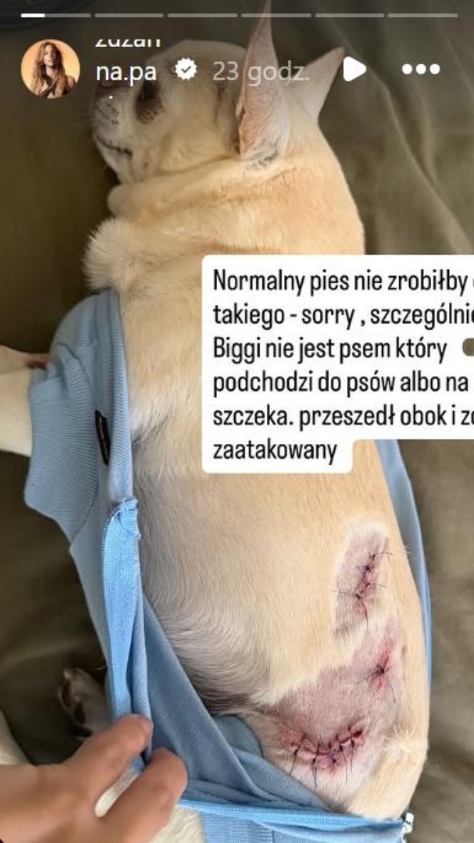 Uwaga! Partnerka Bieniuka walczyła z agresywnym psem! Przerażające zdjęcia