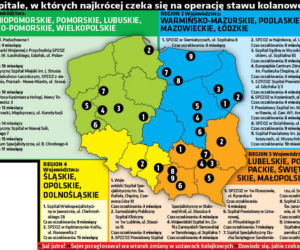 Wylecz kolano bez kolejki