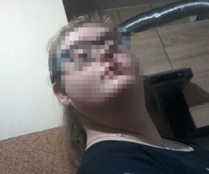 Zakażone koronawirusem rodzeństwo nie żyje