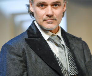 Jan Wieczorkowski przed przeszczepem włosów