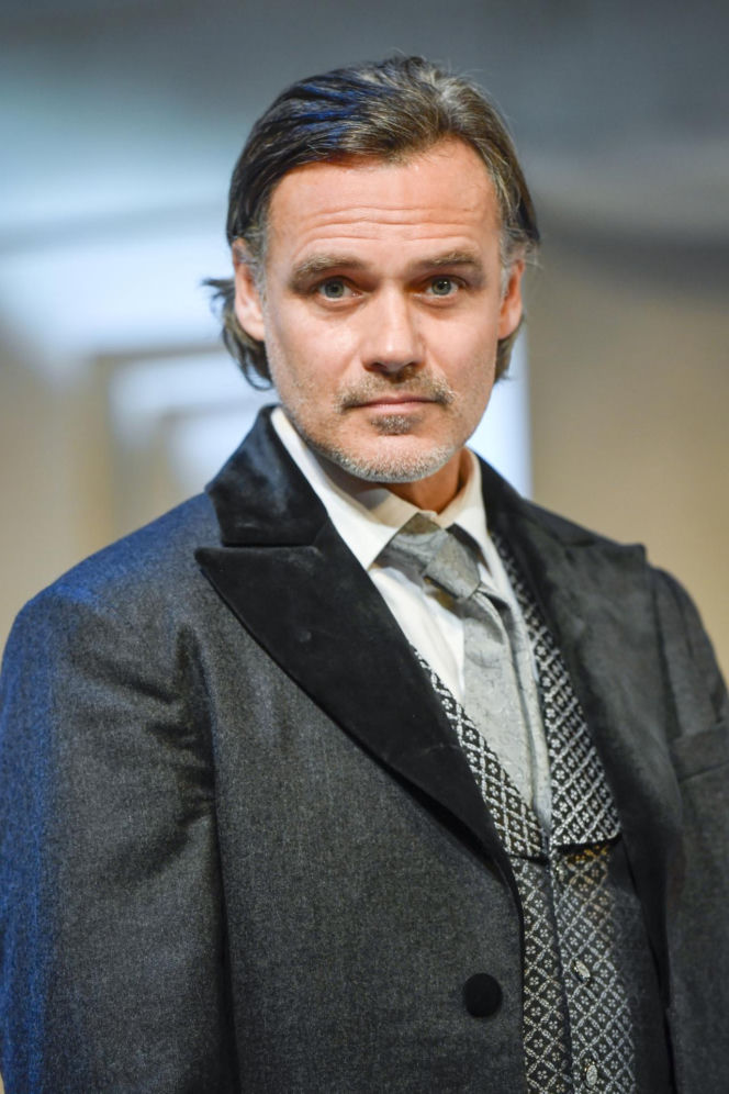 Jan Wieczorkowski przed przeszczepem włosów