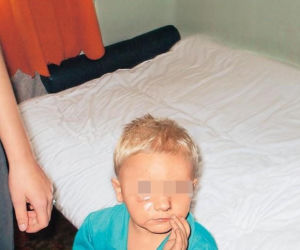 4-letni Oskarek skatowany na śmierć. Wybite zęby, połamane ręce i poparzenia. Przed śmiercią ważył 10 kg