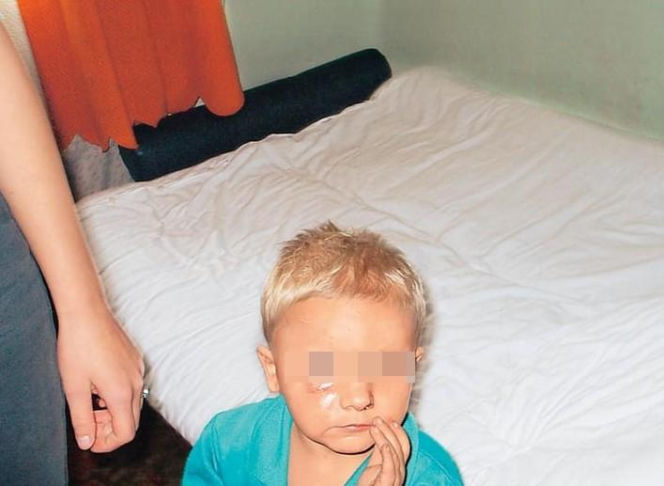 4-letni Oskarek skatowany na śmierć. Wybite zęby, połamane ręce i poparzenia. Przed śmiercią ważył 10 kg