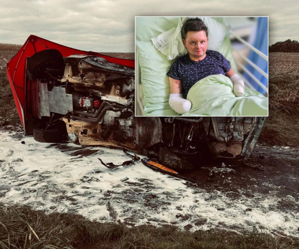 Stracił obie dłonie i ledwo uszedł z życiem. Jego przyjaciel nie miał tyle szczęścia. Dramatyczna historia wicestarosty