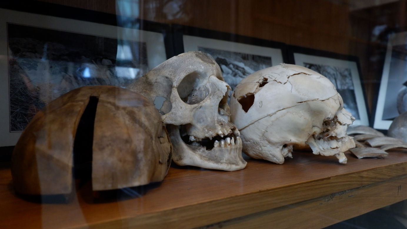 "Muzeum" Zakładu Medycyny Sądowej w Krakowie. Tu przechowuje się narzędzia głośnych zbrodni [ZDJĘCIA]