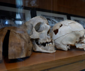Muzeum Zakładu Medycyny Sądowej w Krakowie. Tu przechowuje się narzędzia głośnych zbrodni [ZDJĘCIA]