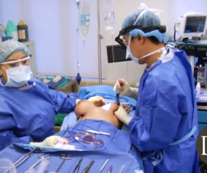 Operacja biustu od A do D. Tak to wygląda w praktyce [ZDJĘCIA]