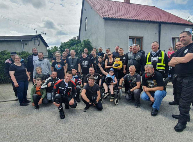 Gabryś przeszedł 17 operacji, tylko na twarzy i dłoniach nie ma blizn. Jego pają jest pomoc innym!