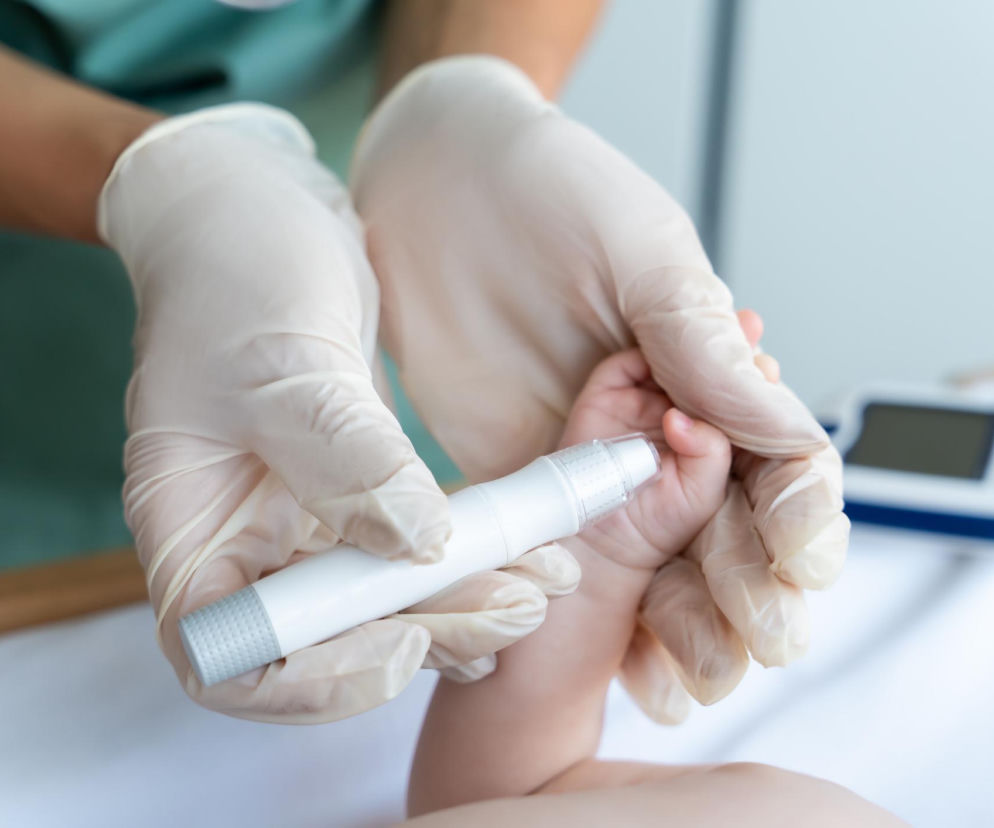 Lekarz lub pielęgniarka w białych rękawiczkach pobiera krew z palca niemowlaka za pomocą glukometru, aby zmierzyć poziom cukru we krwi. To ważne badanie diagnostyczne w przypadku cukrzycy u niemowląt, o której więcej przeczytasz na Poradnik Zdrowie.