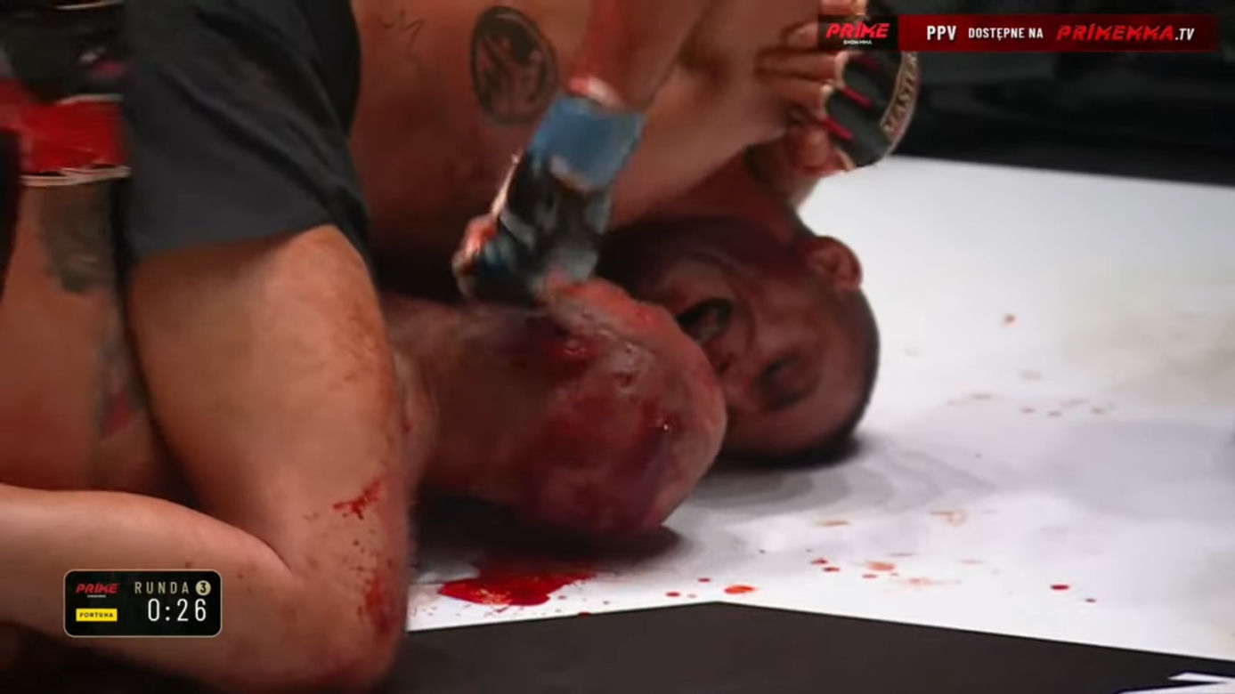 Krwawa rzeź w walce na PRIME MMA