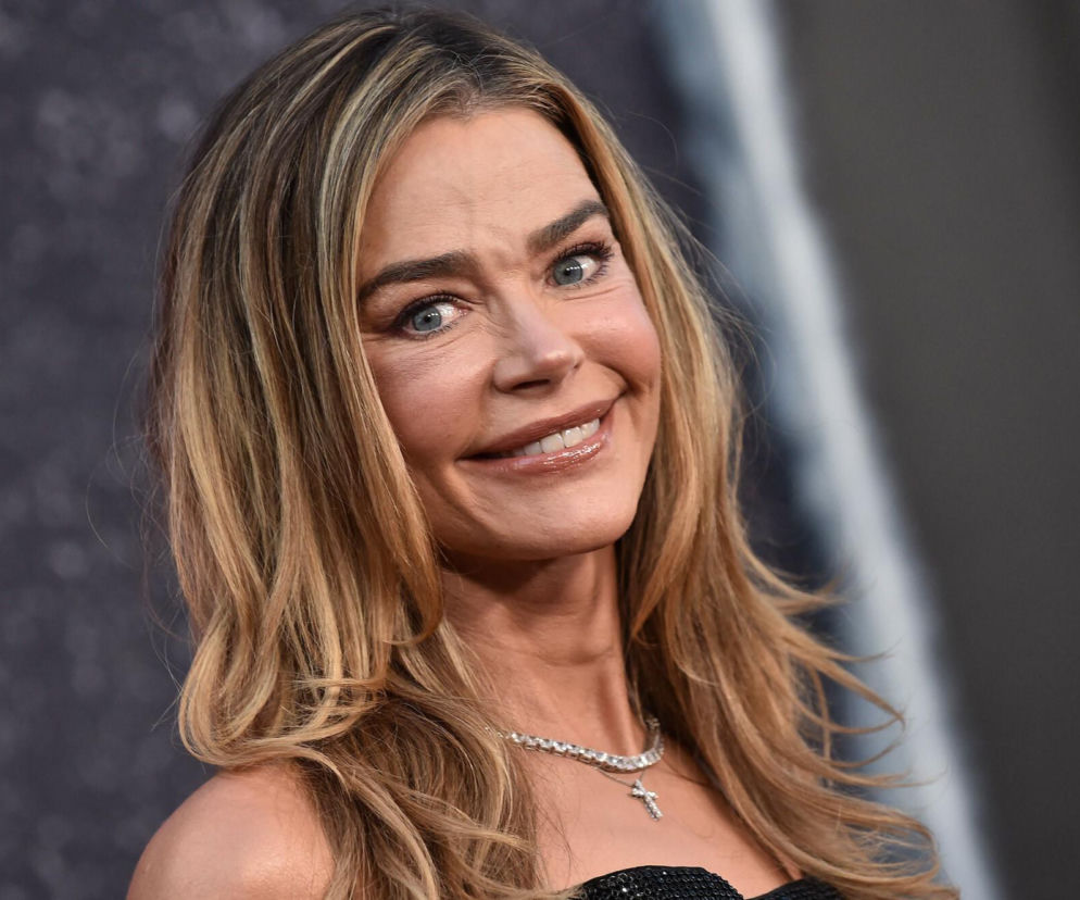 Denise Richards i jej lifting twarzy szokują. Aktorka się tłumaczy i pokazuje nagranie z zabiegu