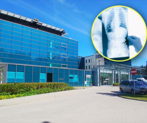 Bezpłatne badania mogą uratować życie. W Szczecinie rusza program profilaktyki raka płuca