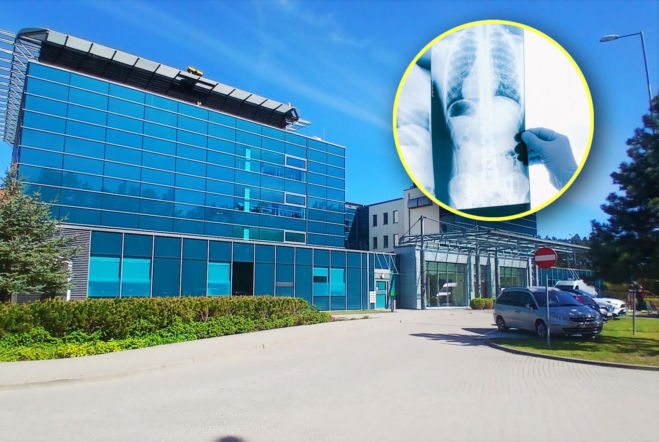 Bezpłatne badania mogą uratować życie. W Szczecinie rusza program profilaktyki raka płuca